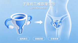 医疗器械|产品原理演示3D动画|子宫托